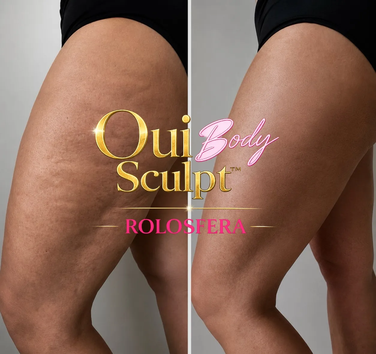 Oui Body Sculpt Rolosfera tretman